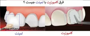 تفاوت لمینت و کامپوزیت